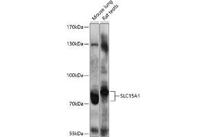 Western Blotting (WB) image for anti-Solute Carrier Family 15 (Oligopeptide Transporter), Member 1 (SLC15A1) (AA 600-700) antibody (ABIN6147853)