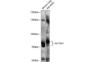 Western blot analysis of extracts of various cell lines, using SLC15 antibody (0246) at 1:1000 dilution. (SLC15A1 抗体  (AA 600-700))