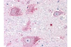 Immunohistochemical staining of Brain (Neurons and Glia) using anti- CHRM3 antibody ABIN122325 (CHRM3 抗体  (C-Term))