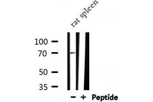 Western blot analysis of PLK3 expression in Rat spleen lysate (PLK3 抗体  (Internal Region))