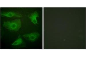 Immunofluorescence analysis of HeLa cells, using IkappaB-epsilon (Phospho-Ser22) Antibody. (IkappaB-epsilon 抗体  (pSer22))