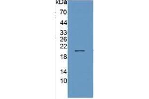 Western Blotting (WB) image for Membrane Metallo-Endopeptidase (MME) ELISA Kit (ABIN6730947)