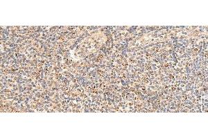 Immunohistochemistry of paraffin-embedded Human tonsil tissue using MRPL16 Polyclonal Antibody at dilution of 1:50(x200) (MRPL16 抗体)