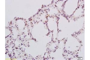 Formalin-fixed and paraffin embedded rat lung tissue labeled with Anti GPR78 Polyclonal Antibody, Unconjugated (ABIN734723) at 1:200 followed by conjugation to the secondary antibody and DAB staining