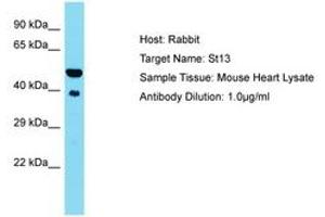 Image no. 1 for anti-Suppression of Tumorigenicity 13 (ST13) (AA 41-90) antibody (ABIN6750401)