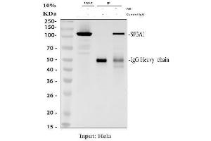 anti-Splicing Factor 3a, Subunit 1 (SF3A1) (AA 20-556) antibody
