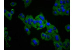 Immunofluorescence staining of HepG2 cells with ABIN7156434 at 1:133, counter-stained with DAPI. (ITGA3 抗体  (AA 168-276))