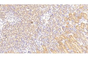 Detection of TGFbR3 in Mouse Kidney Tissue using Polyclonal Antibody to Transforming Growth Factor Beta Receptor III (TGFbR3) (TGFBR3 抗体  (AA 469-724))