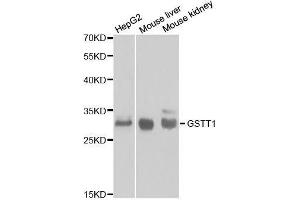 Western blot analysis of extracts of various cell lines, using GSTT1 antibody. (GSTT1 抗体  (AA 1-240))