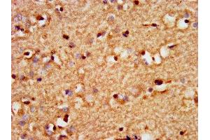 IHC image of ABIN7172623 diluted at 1:300 and staining in paraffin-embedded human brain tissue performed on a Leica BondTM system. (SOX3 抗体  (AA 4-118))