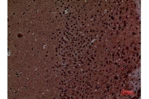 Immunohistochemistry (IHC) image for anti-Layilin (LAYN) (Internal Region) antibody (ABIN3187757)