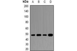 Western blot analysis of DAX1 expression in Jurkat (A), MCF7 (B), HepG2 (C), mouse spleen (D) whole cell lysates. (NR0B1 抗体)