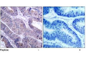 Image no. 1 for anti-Protein Kinase, AMP-Activated, alpha 1 Catalytic Subunit (PRKAA1) (Ser485), (Ser491) antibody (ABIN197320)