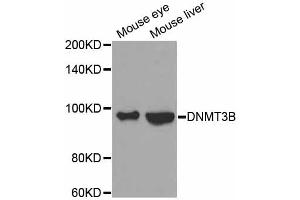 Western blot analysis of extracts of various cell lines, using DNMT3B antibody. (DNMT3B 抗体)
