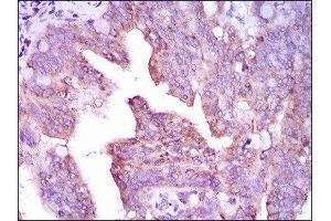 Immunohistochemistry (IHC) image for anti-Calcium/calmodulin-Dependent Protein Kinase IV (CAMK4) (AA 35-292) antibody (ABIN1845379) (CAMK4 抗体  (AA 35-292))