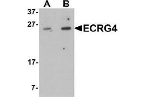 Western blot analysis of ECRG4 in HeLa cell lysate with ECRG4 Antibody  at (A) 1 and (B) 2 μg/mL (C2orf40 抗体  (C-Term))
