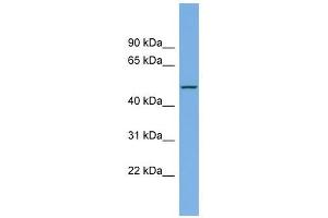 LIPI antibody used at 1 ug/ml to detect target protein. (Lipase I 抗体  (Middle Region))