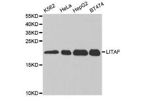 Western blot analysis of extracts of various cell lines, using LITAF antibody. (LITAF 抗体  (AA 1-161))