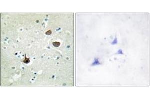 Immunohistochemistry (IHC) image for anti-Chemokine (C-X-C Motif) Receptor 4 (CXCR4) (AA 303-352), (pSer339) antibody (ABIN1531564)