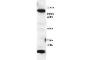 Image no. 1 for anti-5-Methyltetrahydrofolate-Homocysteine Methyltransferase (MTR) (C-Term) antibody (ABIN374080) (MTR 抗体  (C-Term))