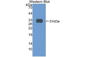Western blot analysis of the recombinant protein. (SIRPG 抗体  (AA 111-372))