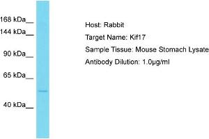Host: Rabbit Target Name: Kif17 Sample Type: Mouse Stomach lysates Antibody Dilution: 1. (KIF17 抗体  (Middle Region))