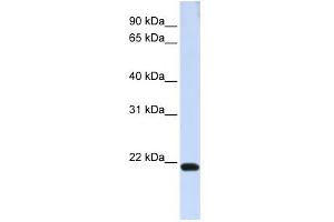TJAP1 antibody used at 1 ug/ml to detect target protein. (TJAP1 抗体)