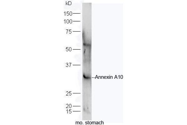 Annexin a10 抗体  (AA 251-324)