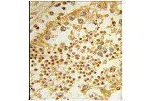Immunohistochemistry analysis in Formalin Fixed, Paraffin Embedded Human Testis using RPL31 Antibody (Center) followed by peroxidase conjugation of the secondary antibody and DAB staining. (RPL31 抗体  (Middle Region))