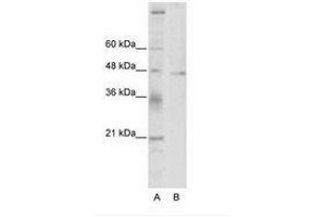 Image no. 1 for anti-Tumor Susceptibility Gene 101 (TSG101) (C-Term) antibody (ABIN202407) (TSG101 抗体  (C-Term))