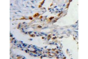 Used in DAB staining on fromalin fixed paraffin-embedded lung tissue (Latexin 抗体  (AA 1-222))