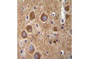 Immunohistochemistry analysis in formalin fixed and paraffin embedded human brain tissue reacted with AP53154PU-N, which was peroxidase conjugated to the secondary antibody and followed by DAB staining. (PAK6 抗体  (Middle Region))
