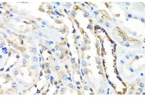 Immunohistochemistry (Paraffin-embedded Sections) (IHC (p)) image for anti-Hyaluronidase-1 (HYAL1) antibody (ABIN7262501)