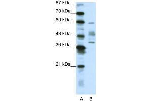 WB Suggested Anti-APTX Antibody Titration:  1. (Aprataxin 抗体  (N-Term))