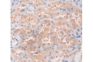 Used in DAB staining on fromalin fixed paraffin- embedded Kidney tissue (ANGPTL5 抗体  (AA 141-383))