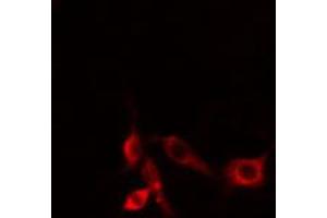 ABIN6274486 staining HepG2 cells by IF/ICC.
