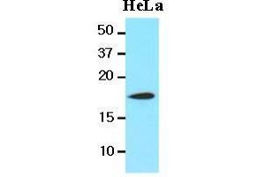The lysates of HeLa(20 ug) were resolved by SDS-PAGE, transferred to nitrocellulose membrane and probed with anti-human Cofilin 1(1:1000) antibody. (Cofilin 抗体  (AA 1-166))