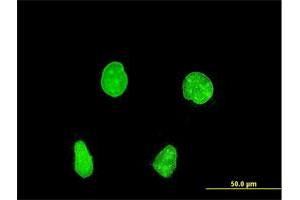 Immunofluorescence (IF) image for anti-Paired Box 8 (PAX8) (AA 300-377) antibody (ABIN563483)