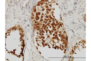 Immunoperoxidase of monoclonal antibody to DAZ1 on formalin-fixed paraffin-embedded human testis. (DAZ1 抗体  (AA 21-120))