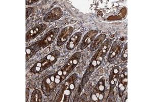 Immunohistochemical staining of human duodenum with ASCC3 polyclonal antibody  strong cytoplasmic positivity in glandular cells.