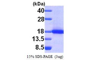 SDS-PAGE (SDS) image for SH2 Domain Containing 1A (SH2D1A) (AA 1-128) protein (His tag) (ABIN667264)