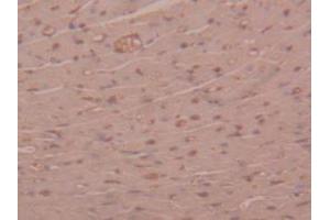 Figure. (alpha 2 Macroglobulin 抗体  (AA 1053-1214))