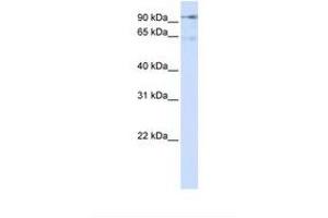 Image no. 1 for anti-Discs, Large (Drosophila) Homolog-Associated Protein 5 (DLGAP5) (AA 38-87) antibody (ABIN6738225) (DLGAP5 抗体  (AA 38-87))