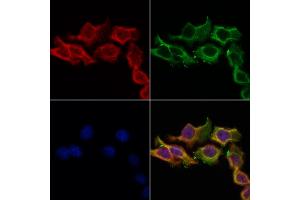 ABIN6256941 and ABIN6274588 staining Hela cells by IF/ICC. (beta Arrestin 1 抗体  (C-Term))