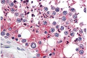 Human Testis (formalin-fixed, paraffin-embedded) stained with UIMC1 antibody ABIN343912 at 5 ug/ml followed by biotinylated goat anti-rabbit IgG secondary antibody ABIN481713, alkaline phosphatase-streptavidin and chromogen. (UIMC1 抗体  (C-Term))
