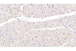 Detection of SOD3 in Human Cardiac Muscle Tissue using Monoclonal Antibody to Superoxide Dismutase 3, Extracellular (SOD3) (SOD3 抗体  (AA 19-240))