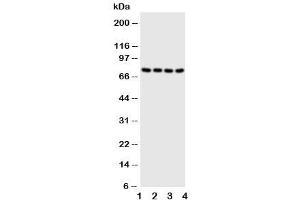 Western blot testing of PAK6 antibody and Lane 1:  HeLa (PAK6 抗体  (N-Term))