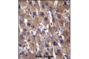 T1A Antibody (N-term) (ABIN656632 and ABIN2845877) immunohistochemistry analysis in forlin fixed and paraffin embedded hun liver tissue followed by peroxidase conjugation of the secondary antibody and DAB staining. (MAT1A 抗体  (N-Term))