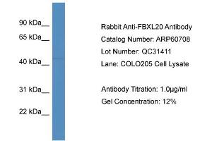 Western Blotting (WB) image for anti-F-Box and Leucine-Rich Repeat Protein 20 (FBXL20) (Middle Region) antibody (ABIN2788547)