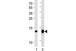 Western Blotting (WB) image for anti-Fatty Acid Binding Protein 4, Adipocyte (FABP4) antibody (ABIN3028654)